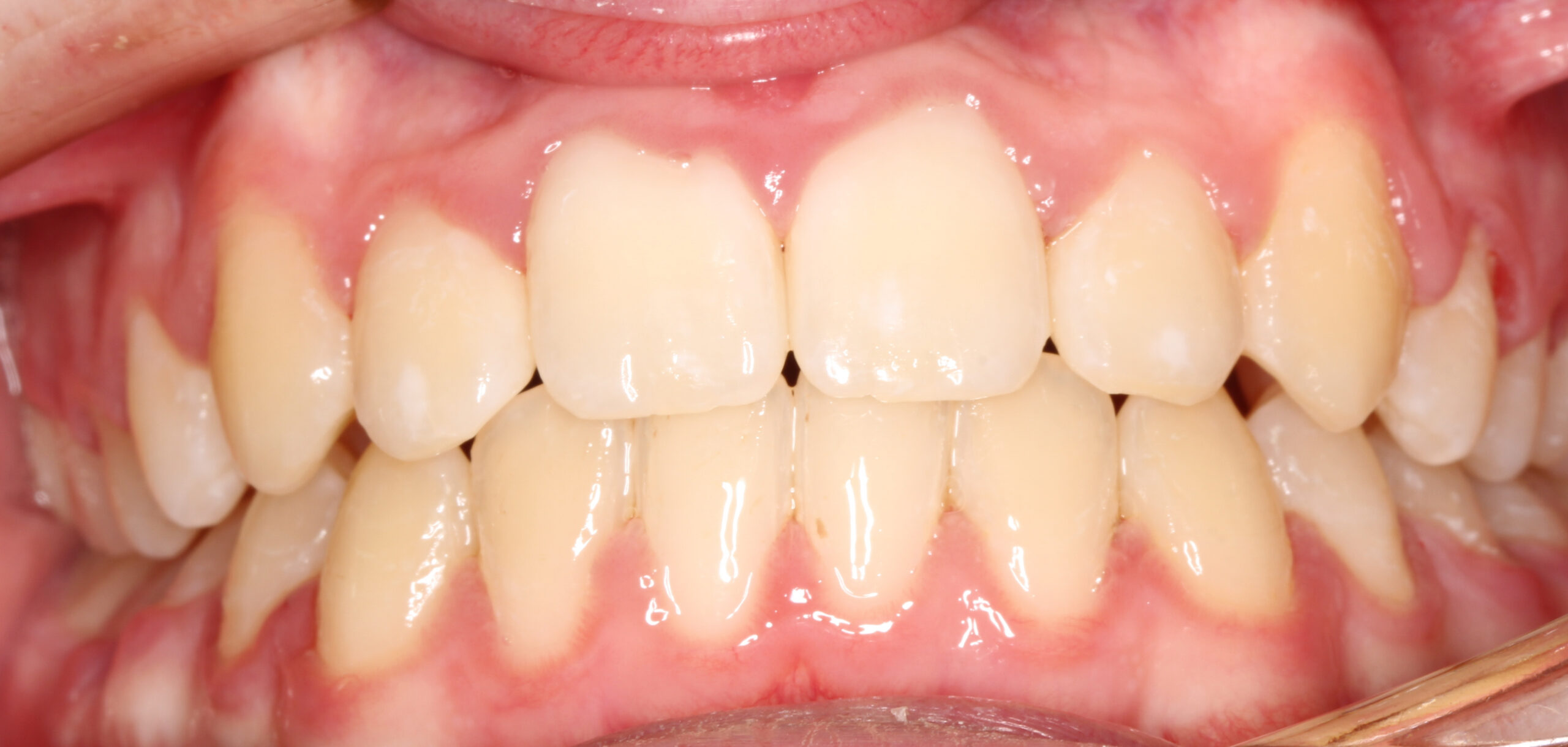 after image