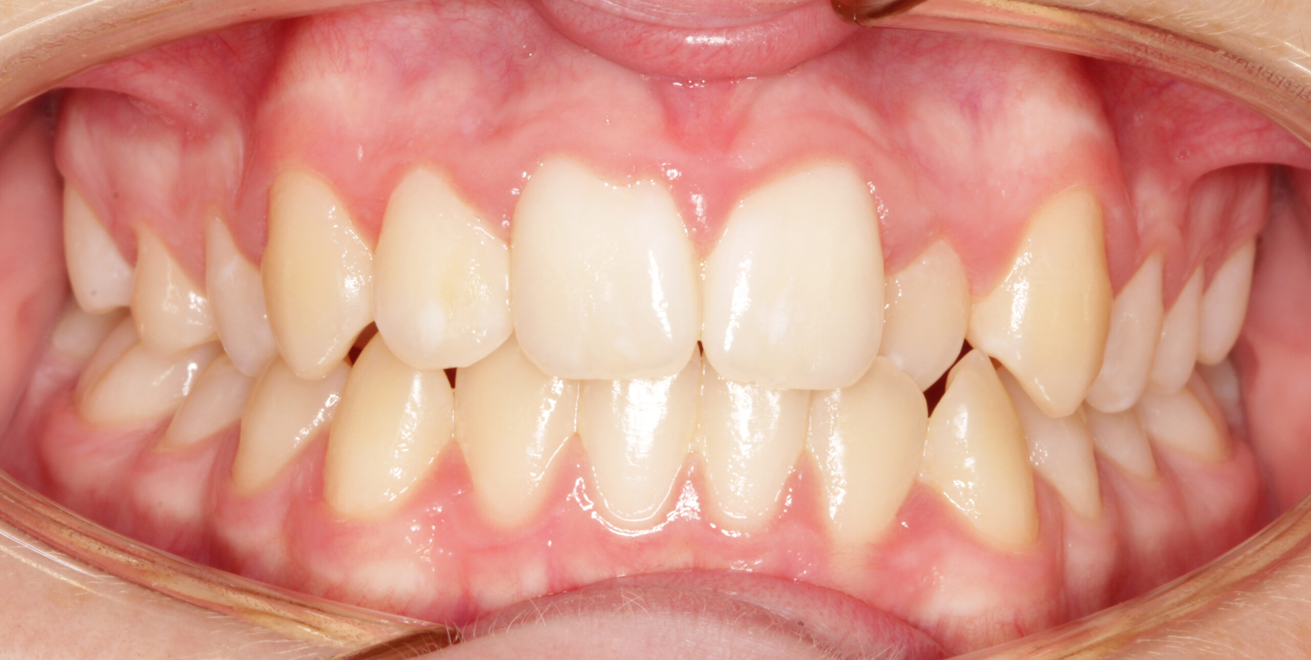 before image