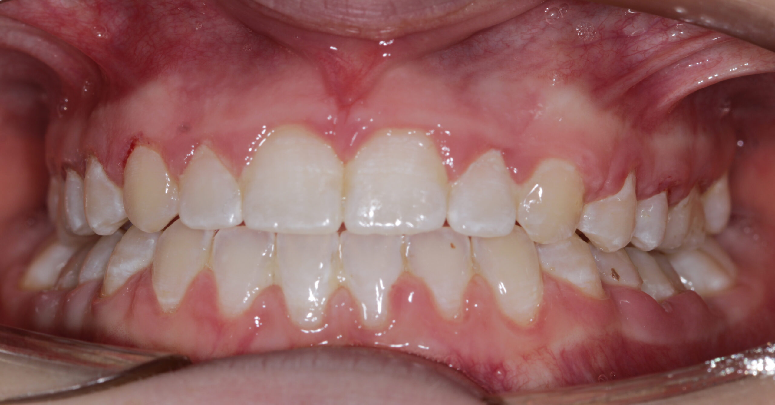 after image