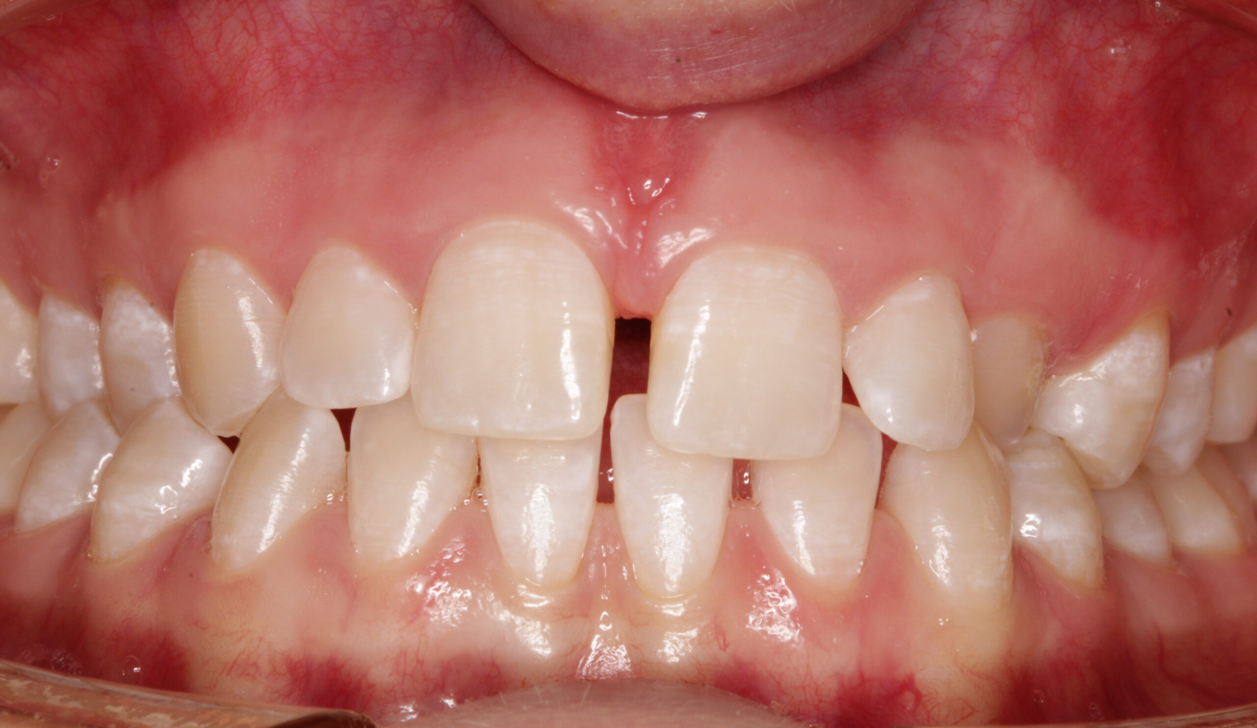 before image