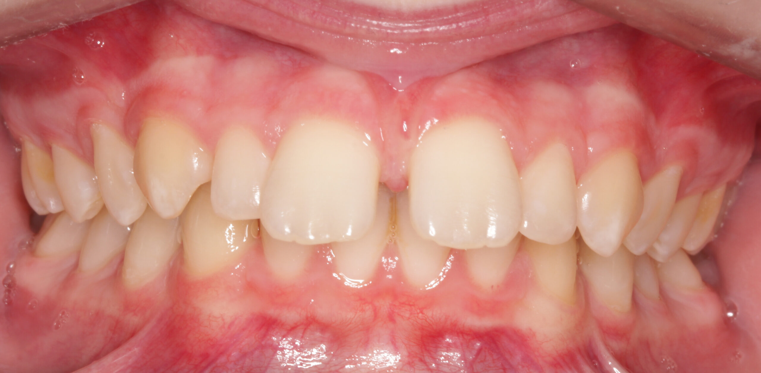 before image