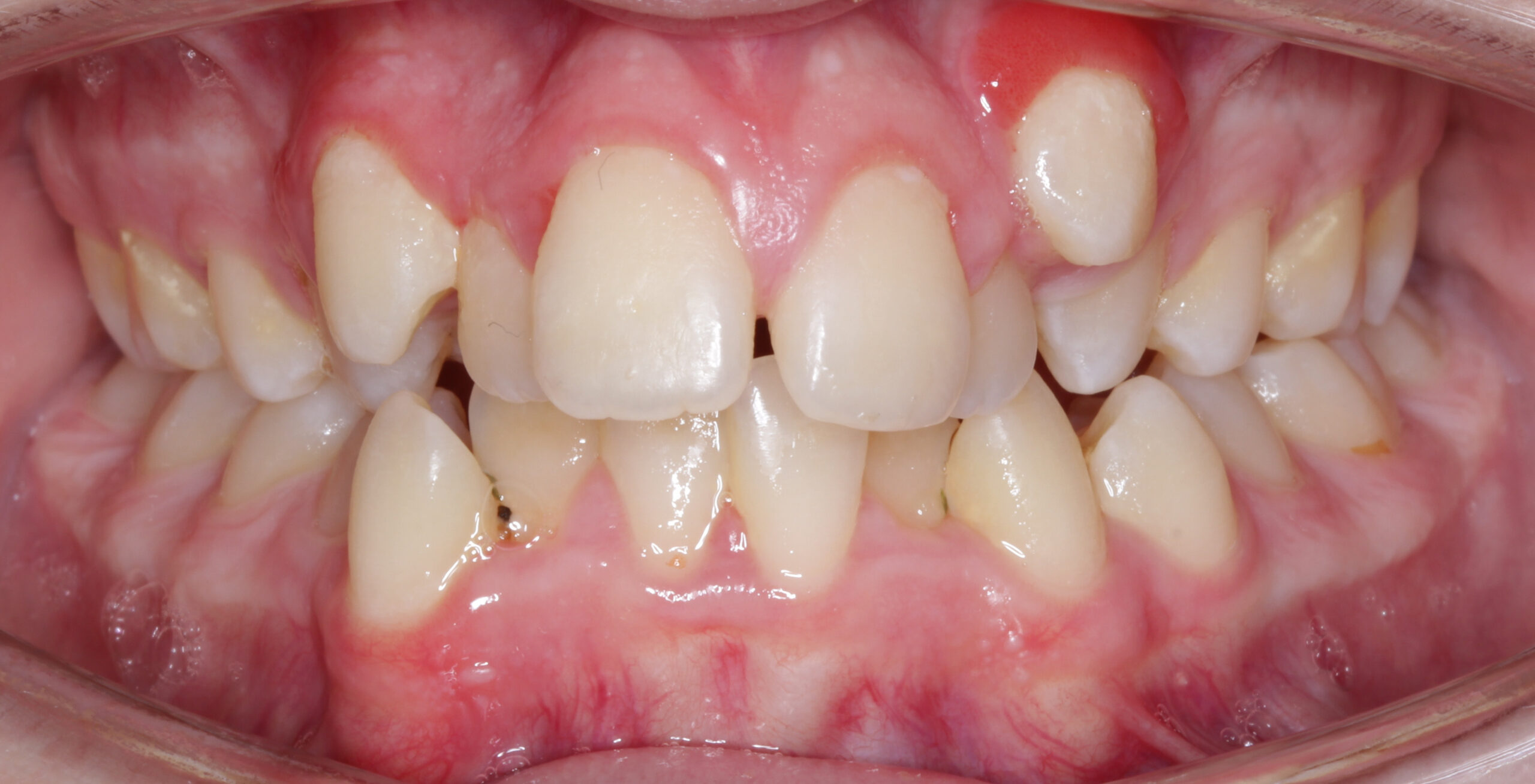 before image