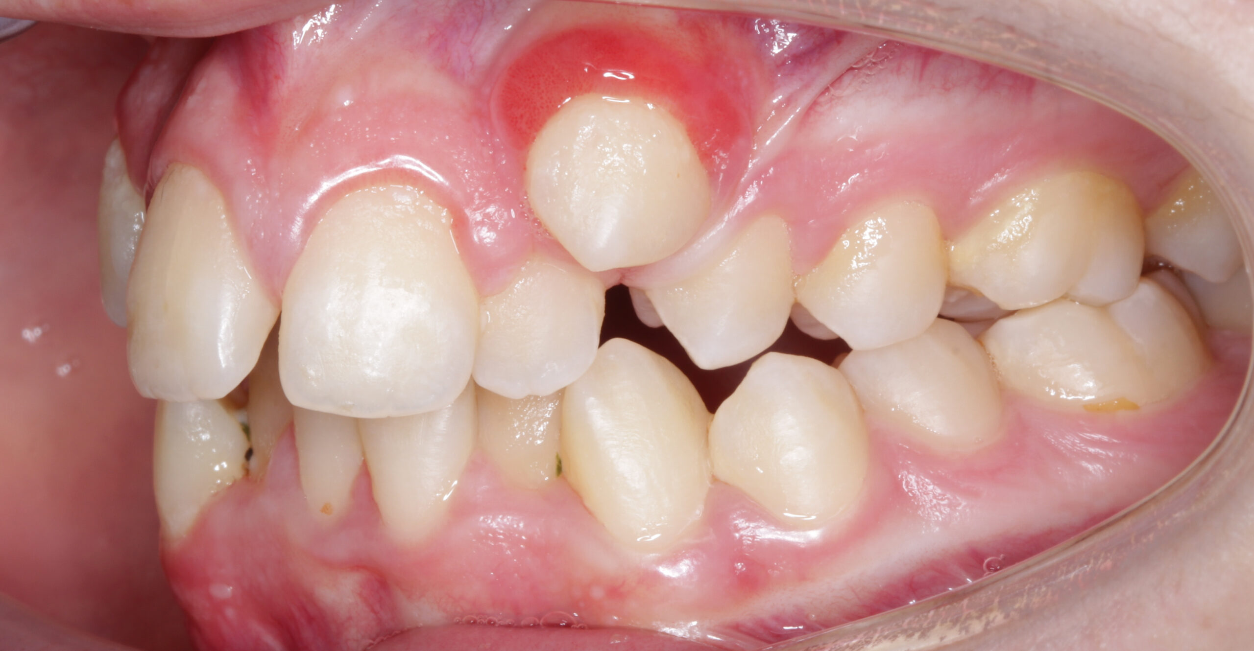 before image