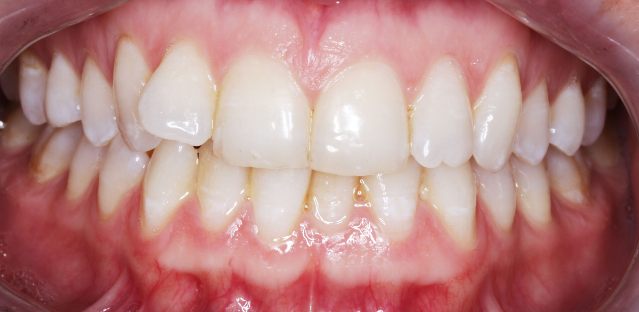 before image